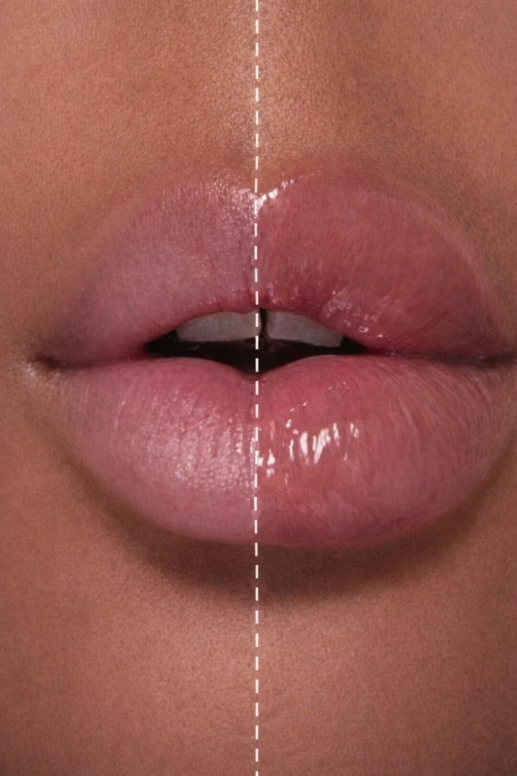 Lip Plumper – Instant Fuller Lips